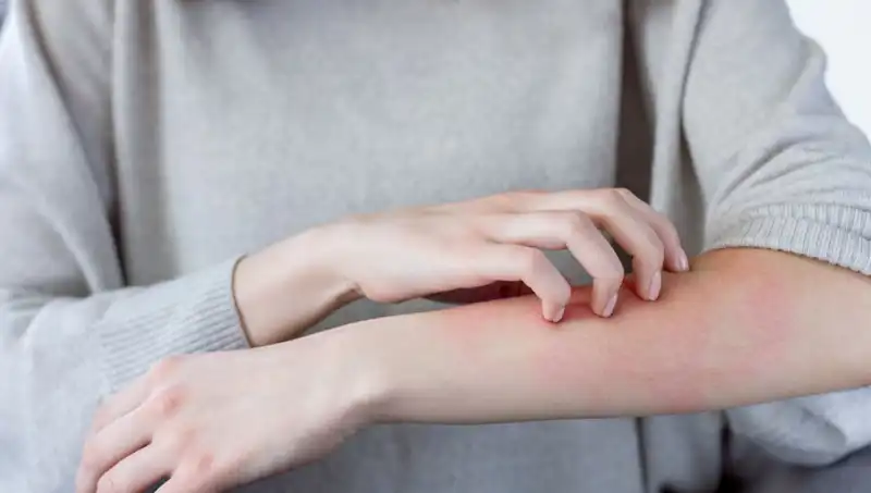 Cilt Kanserinin Gözden Kaçan Belirtileri: Dermatologdan Önemli Uyarılar