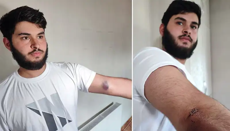 Bahçeye Kaçan Top, Mahallede Gözaltılarla Sonuçlanan Olay Yaratmıştı