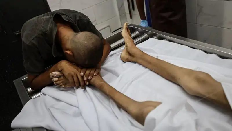 Gazze'de Açlıktan Kaybedilen Bir Çocuk: Krizin Derinleşen Yüzü